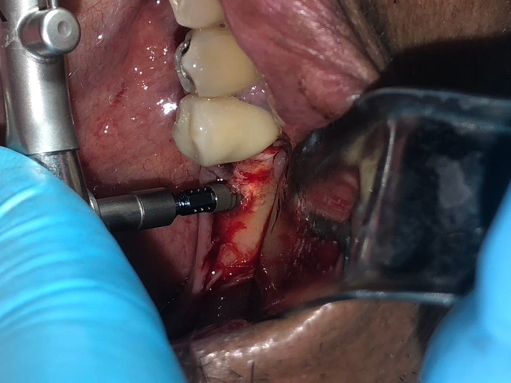 Nancy Anel Duran Alanis-5