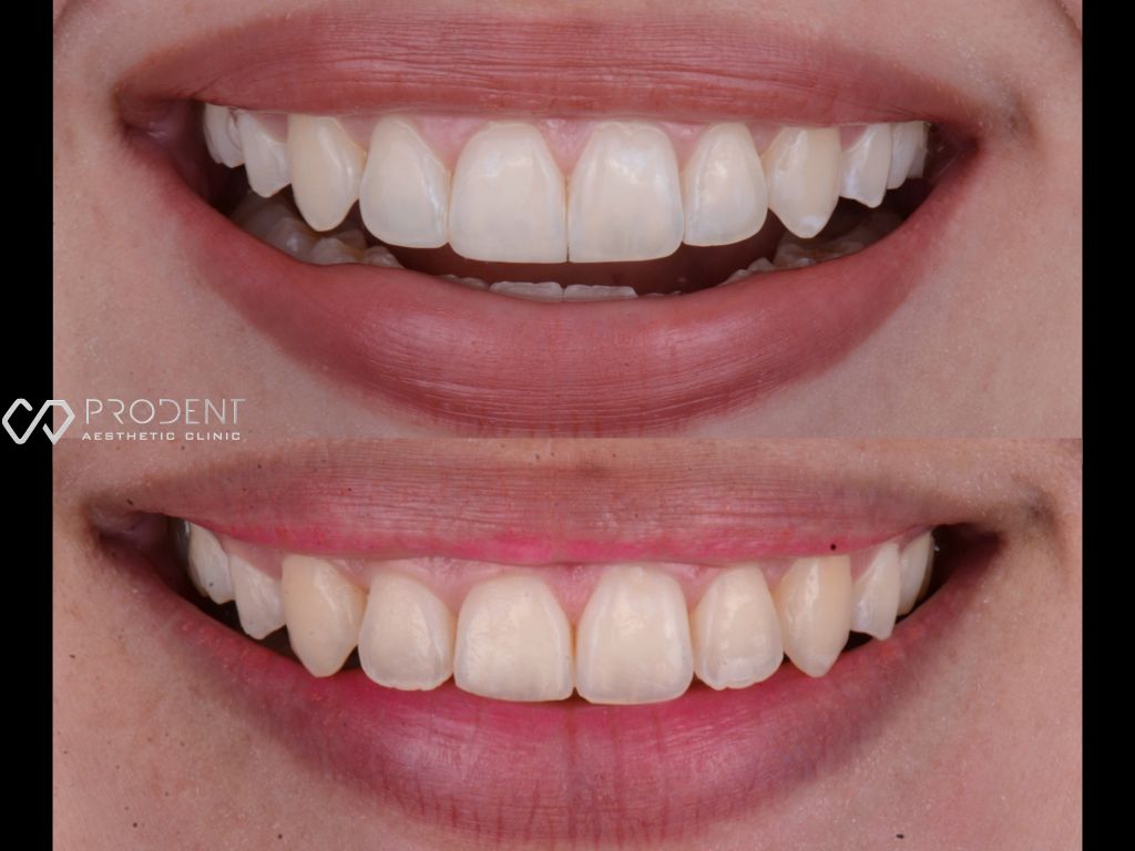 Ulises Pérez Murillo-84