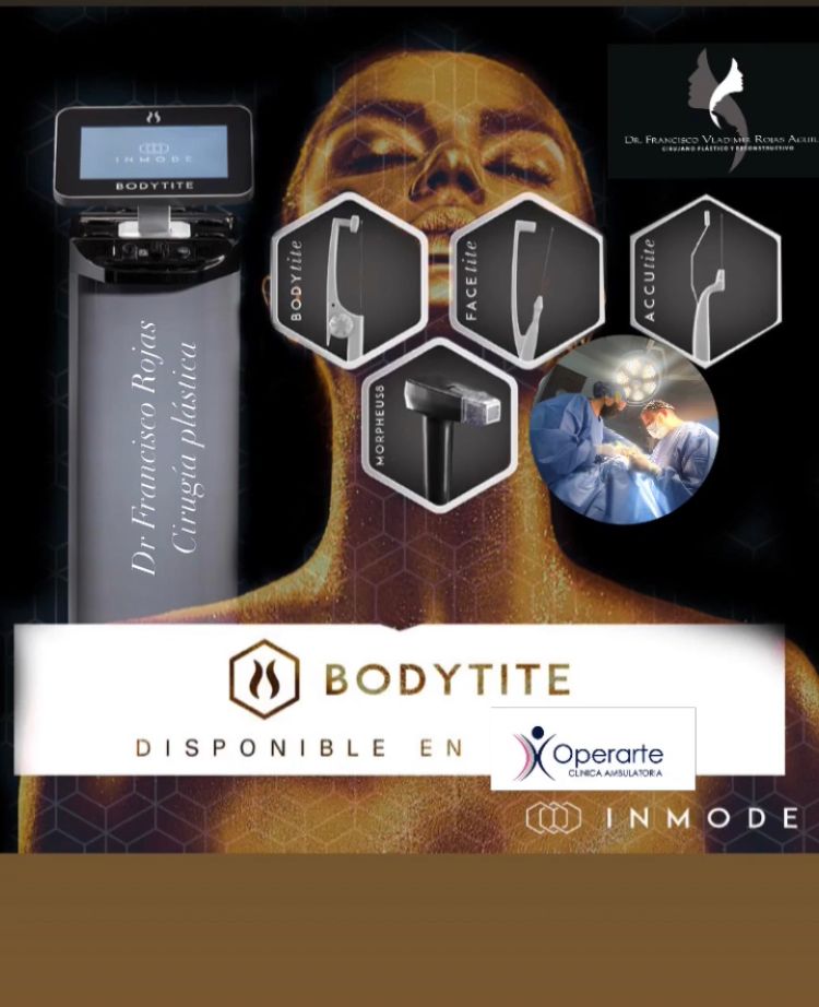 Francisco Rojas Aguilar-1