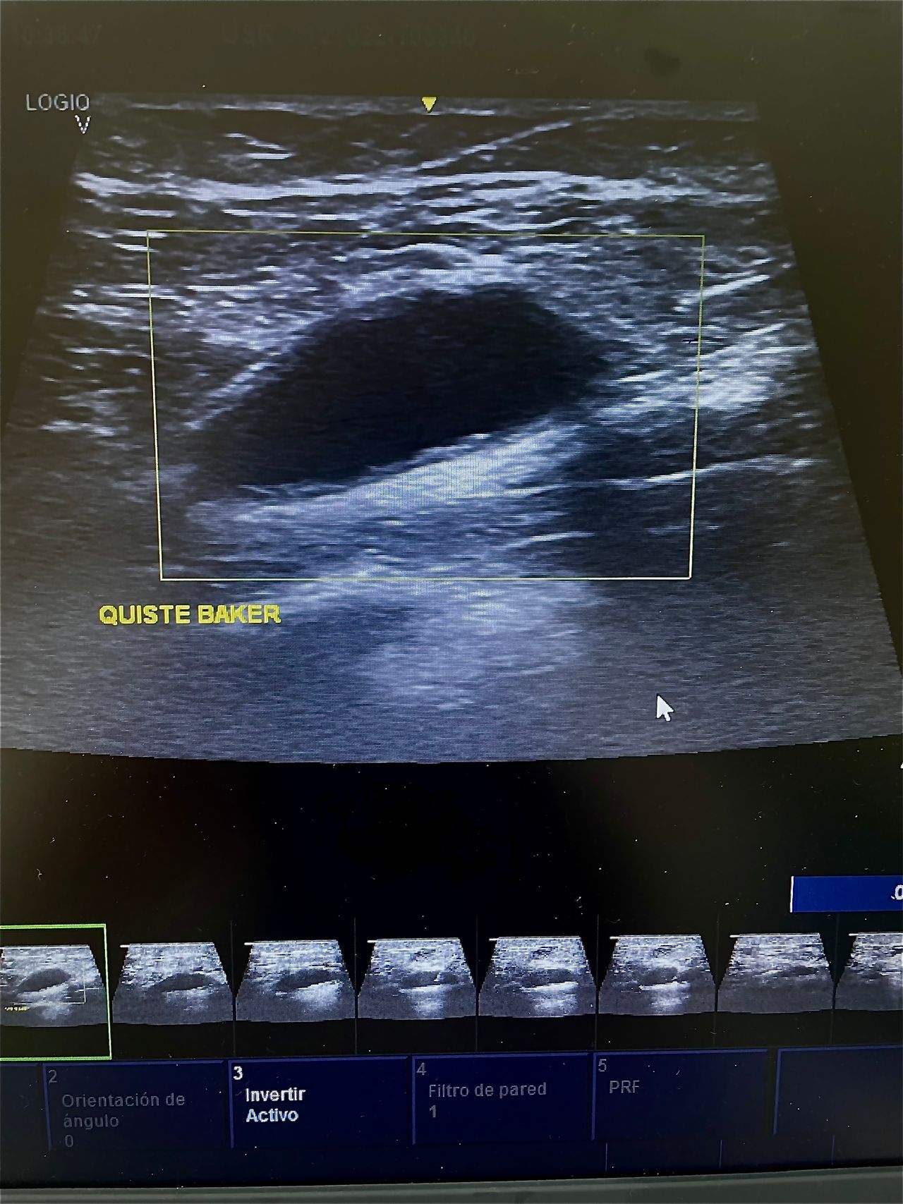 José Ismael Pineda Pérez-0