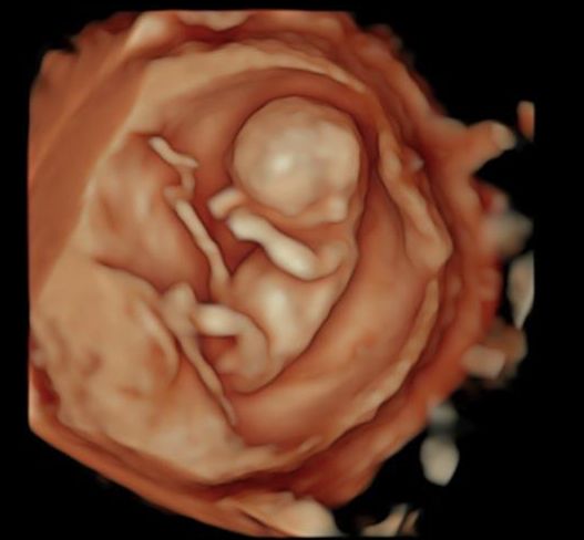 Viridiana Martinez Avendaño-6