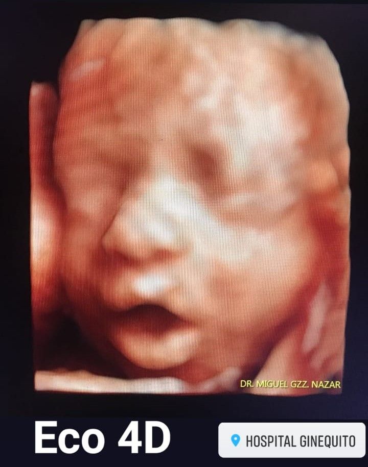 Miguel Angel González Nazar-6