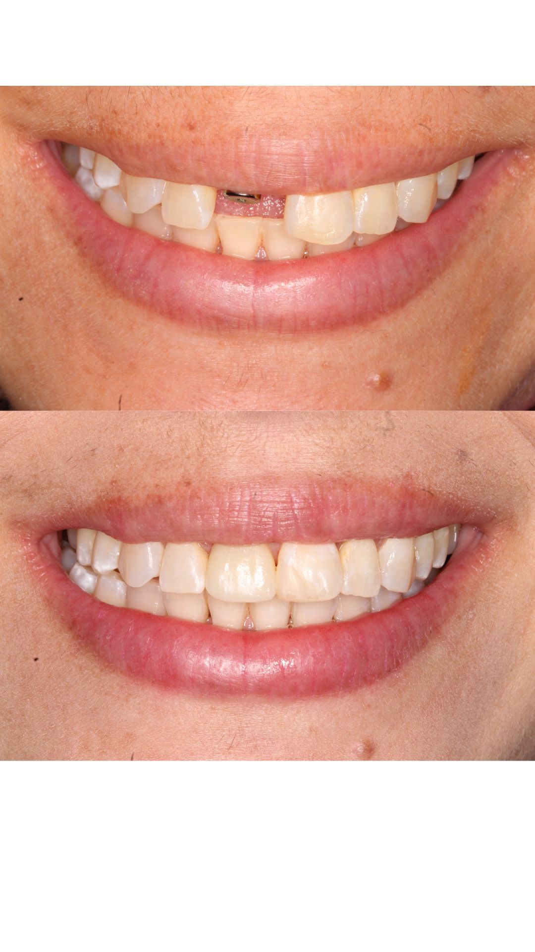 Heidi Mendoza Malagón-12