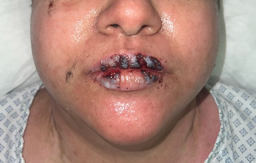 Lauro Francisco Varela Coronado-14