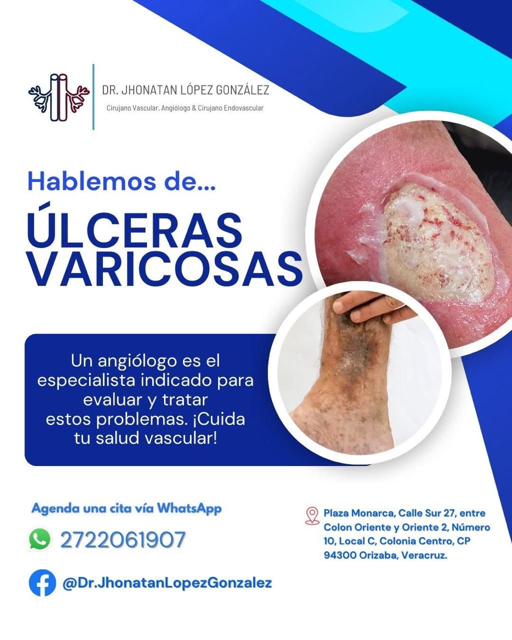 Jhonatan López González-88