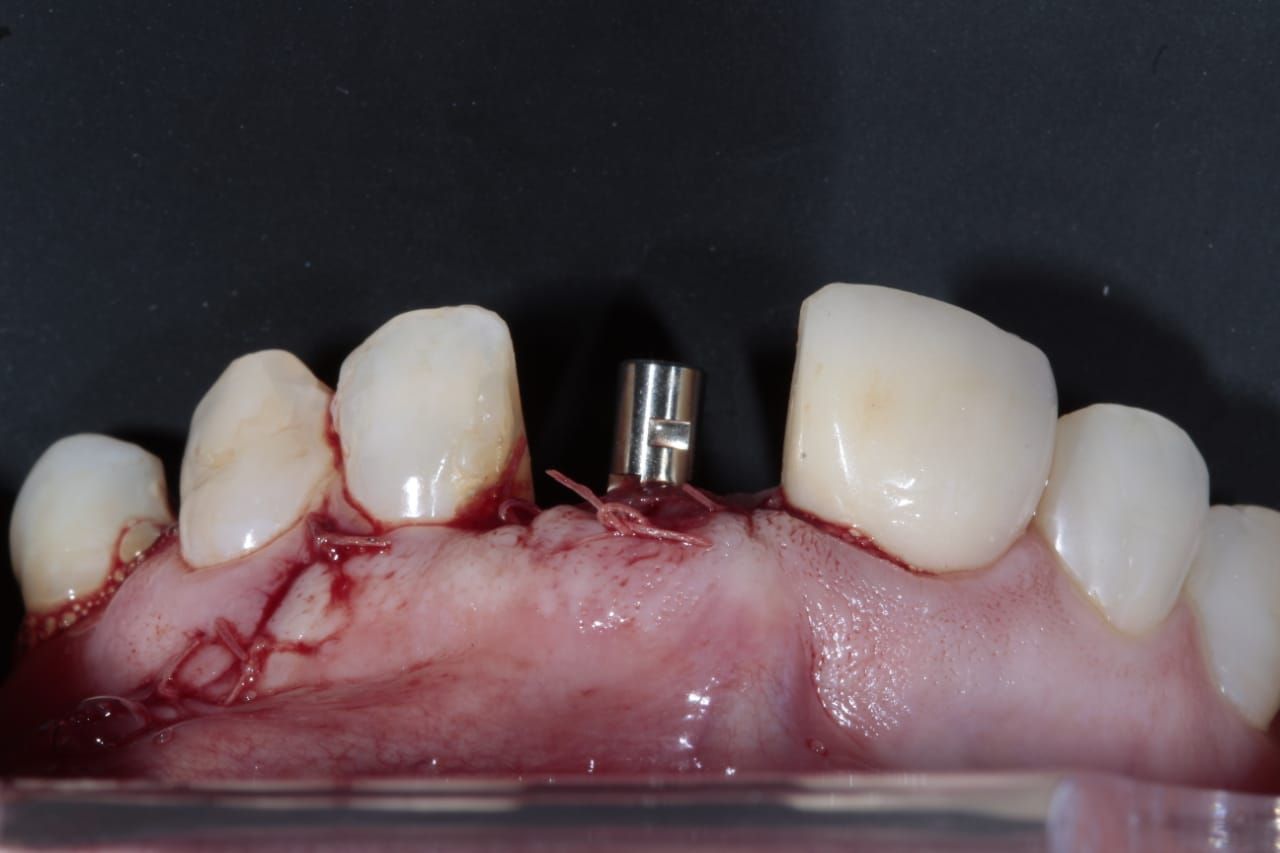 Rafael González Carmona-5