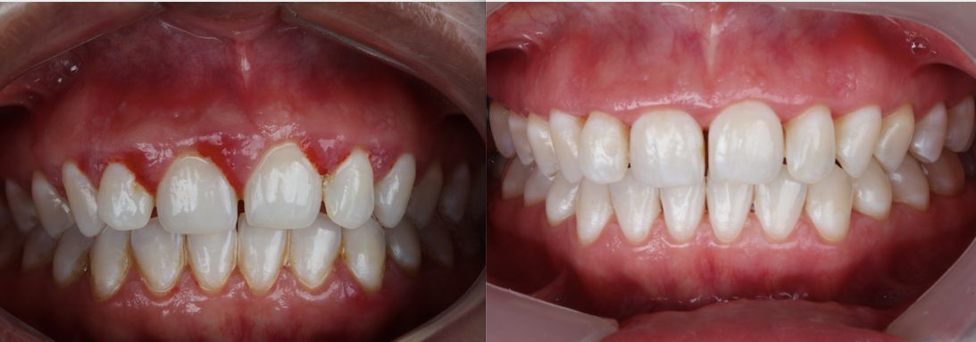 Erika Díaz De León Torres-16