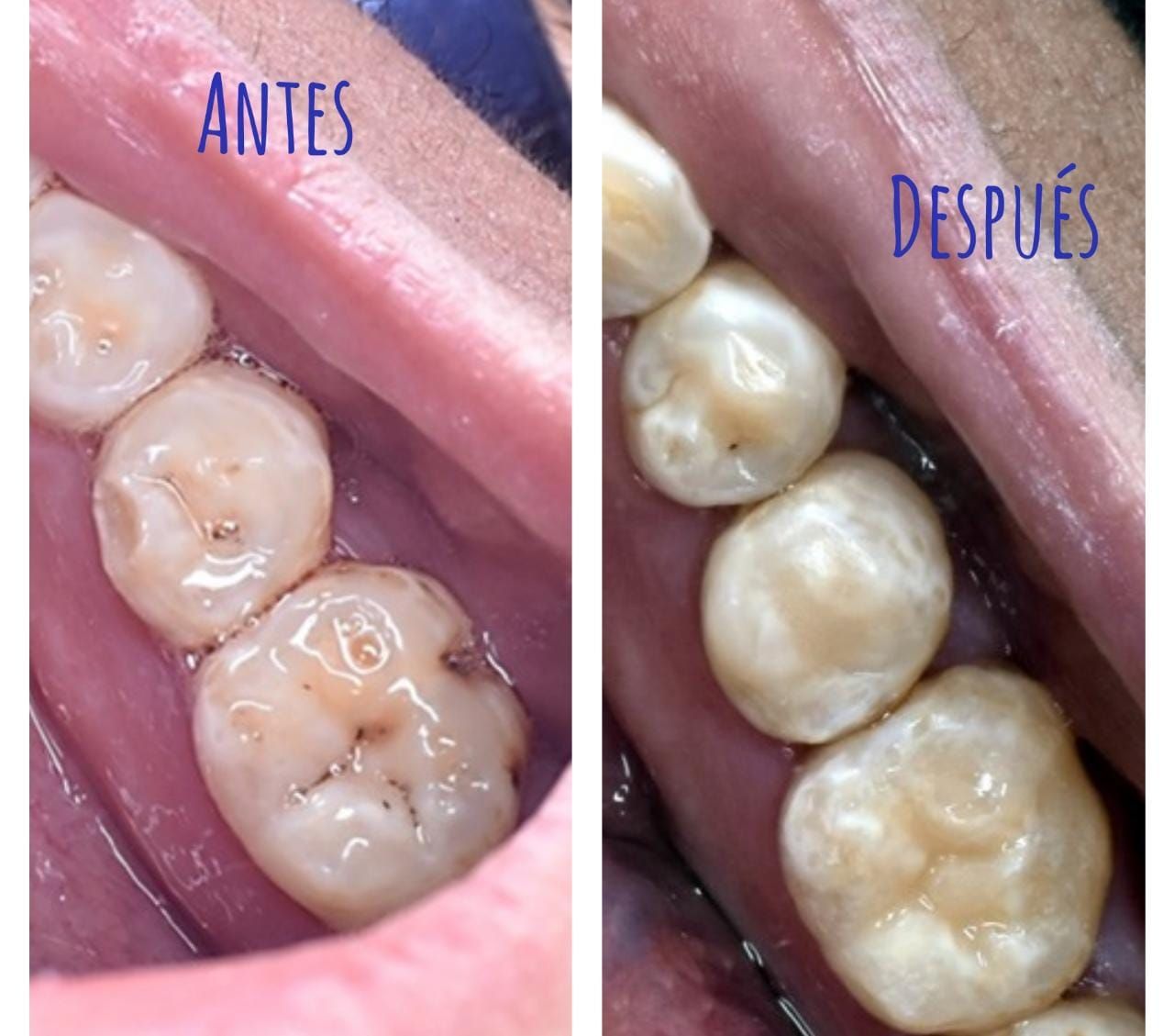 Ricardo Ivan Martínez García-3