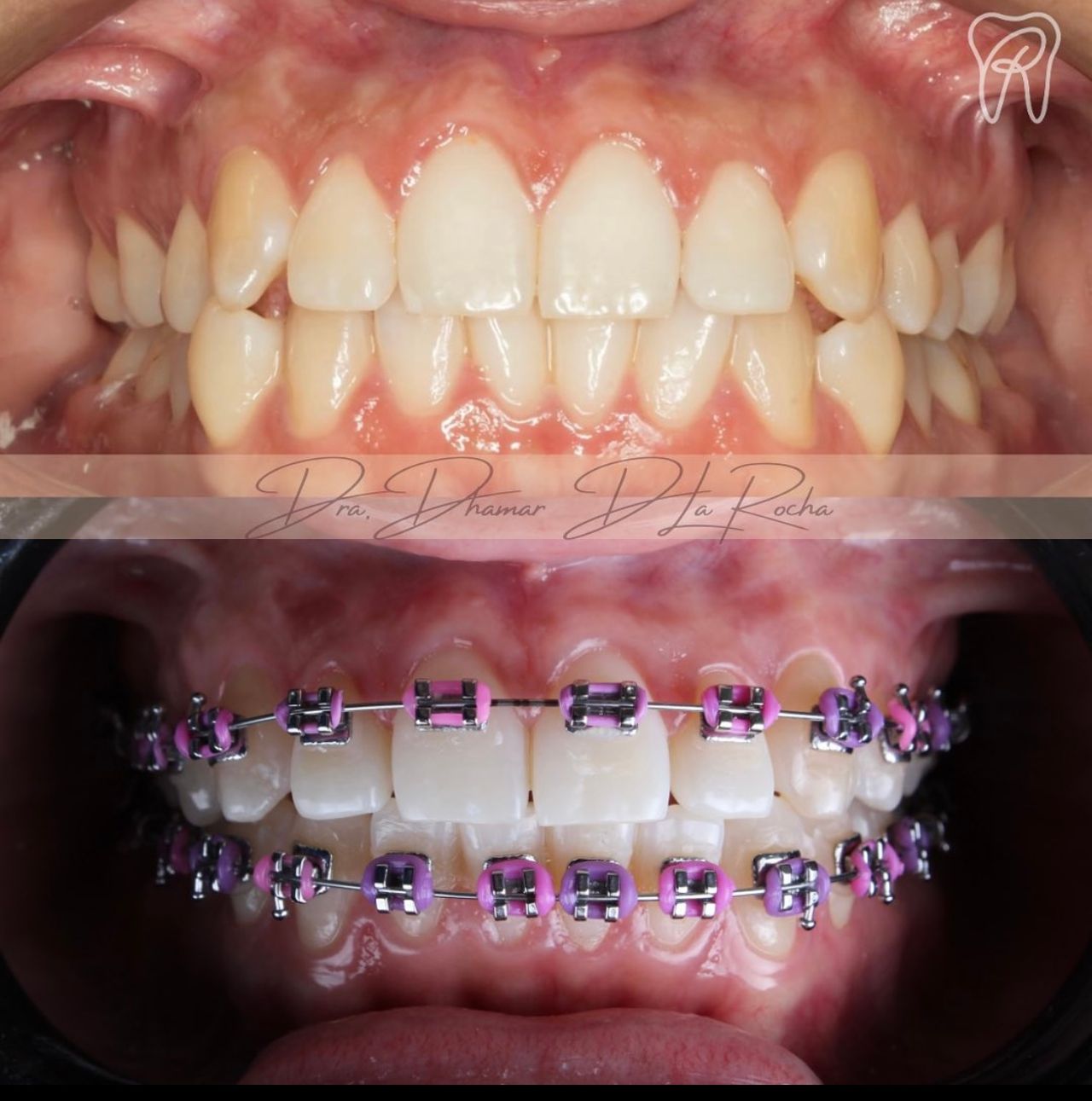 Dhamar De La Rocha Almazan-3