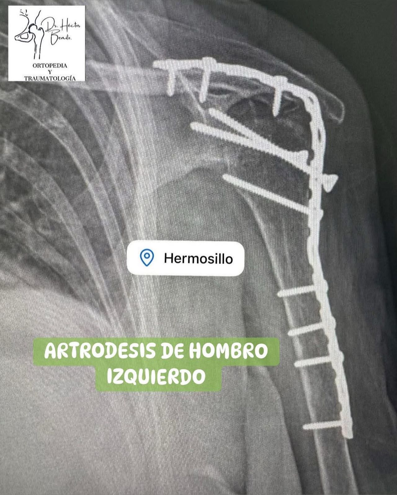 Héctor Benito Lazaro-5