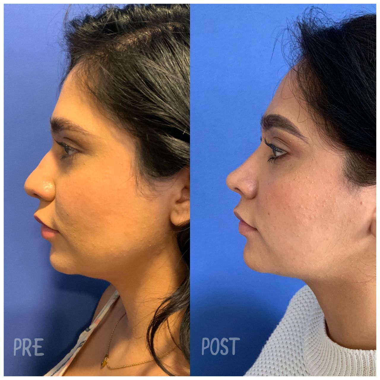 Giuseppe Tanzillo-71