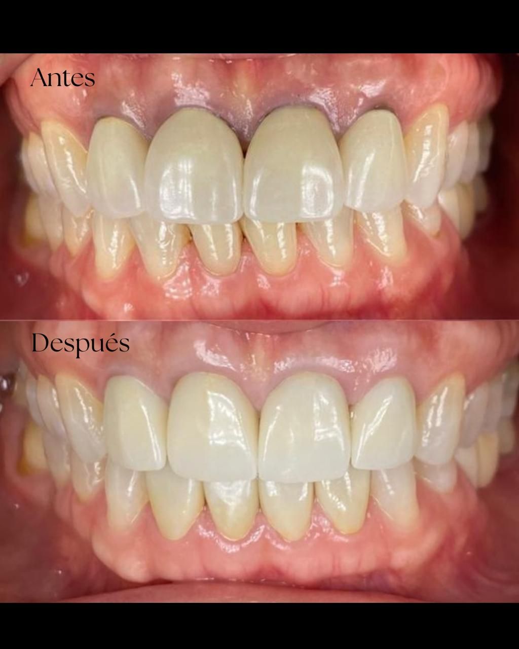 Diana Chacon Cervera-8