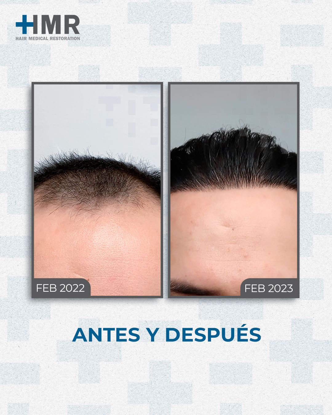 Mendelhsson Mata Cortes-6