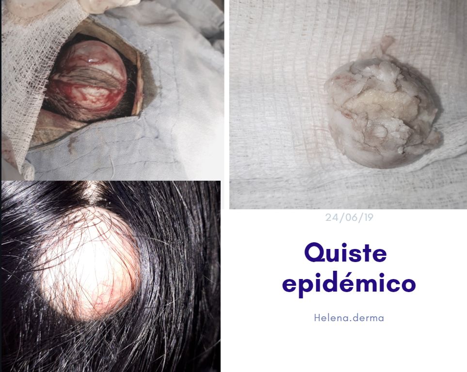 Helena Castro López-1