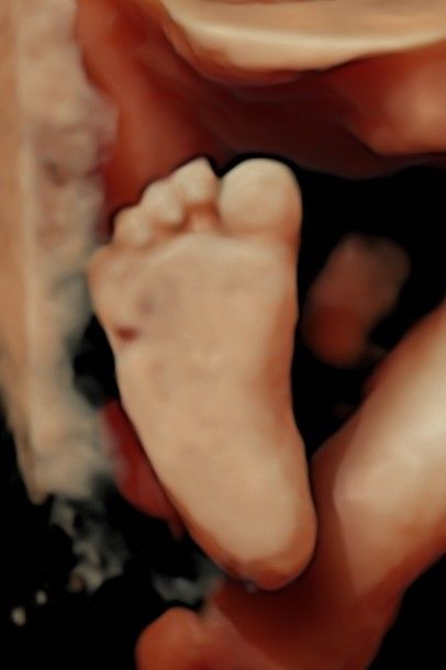 Nallely Moreno  Uribe-8