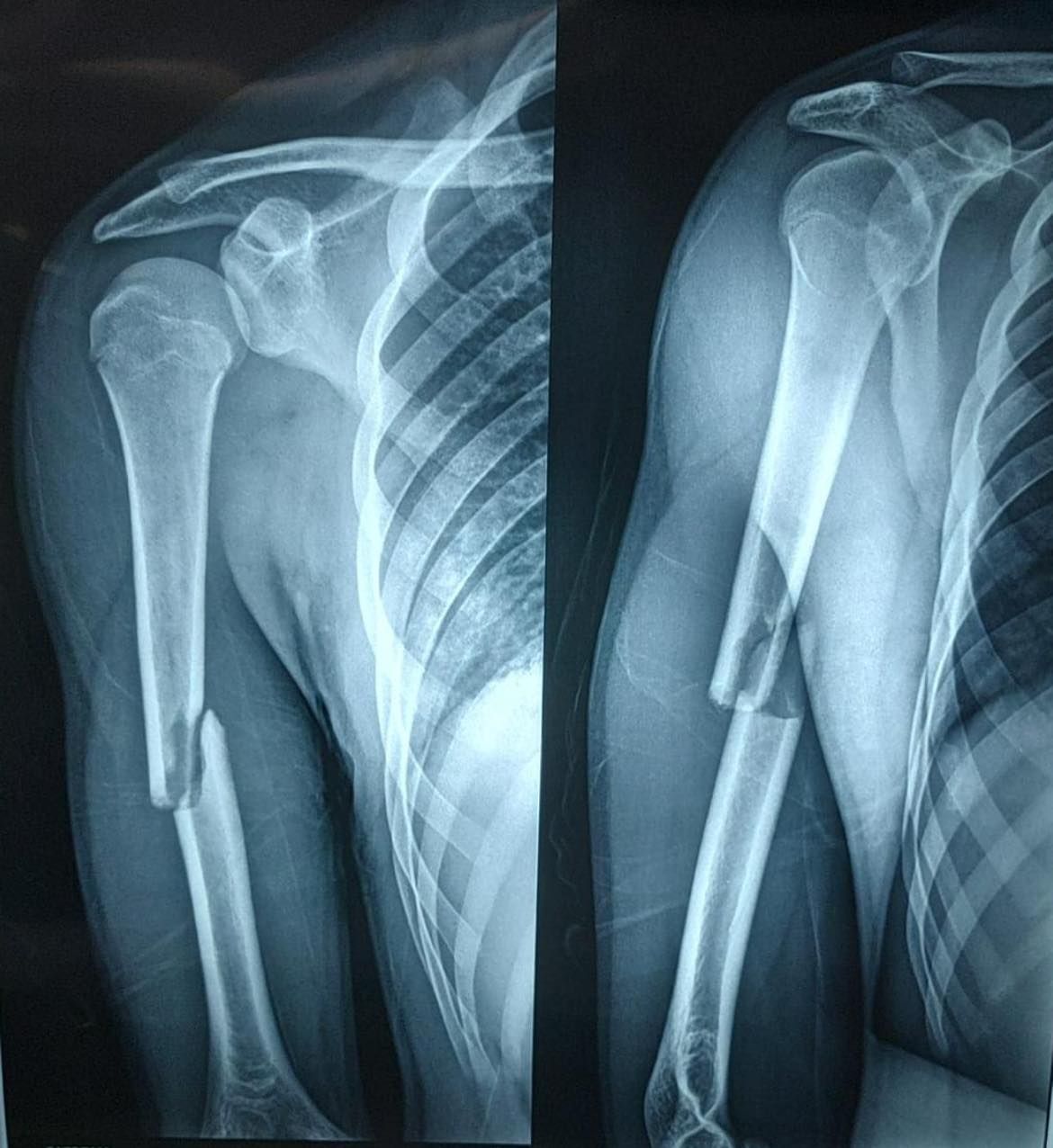 Felix Alfaro Arias-8