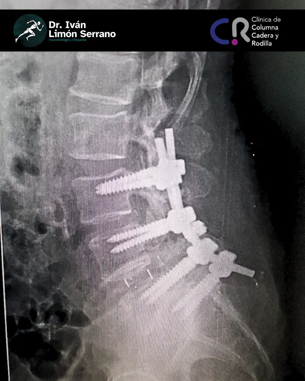 Iván Limón Serrano-26