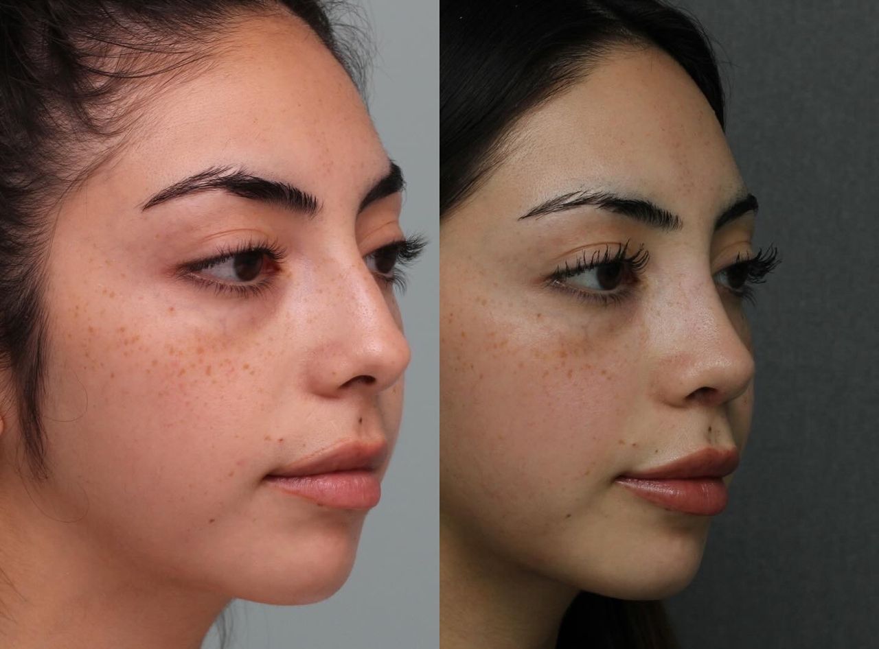 Angel Castro Urquizo-133