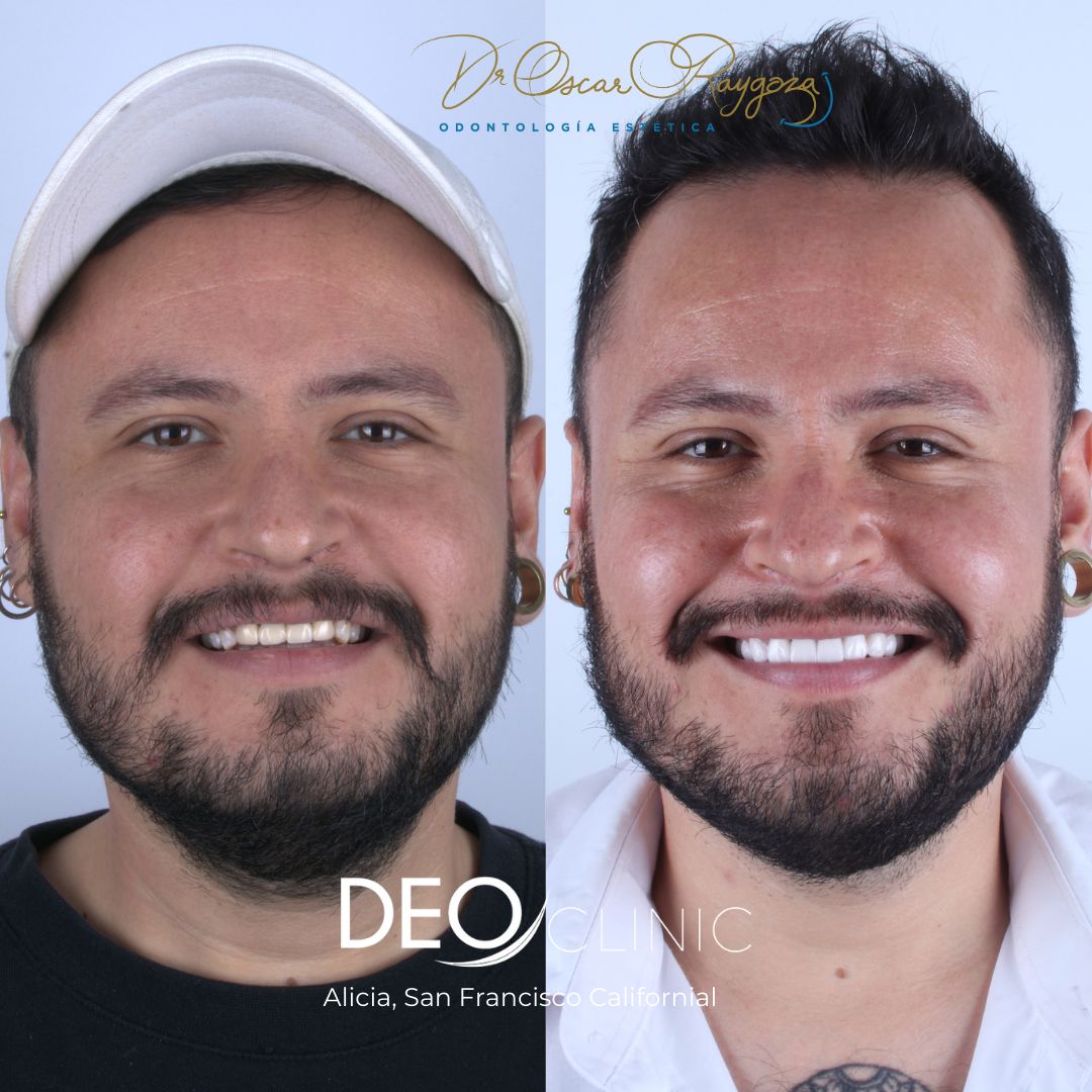 Oscar Raygoza Carrillo-30