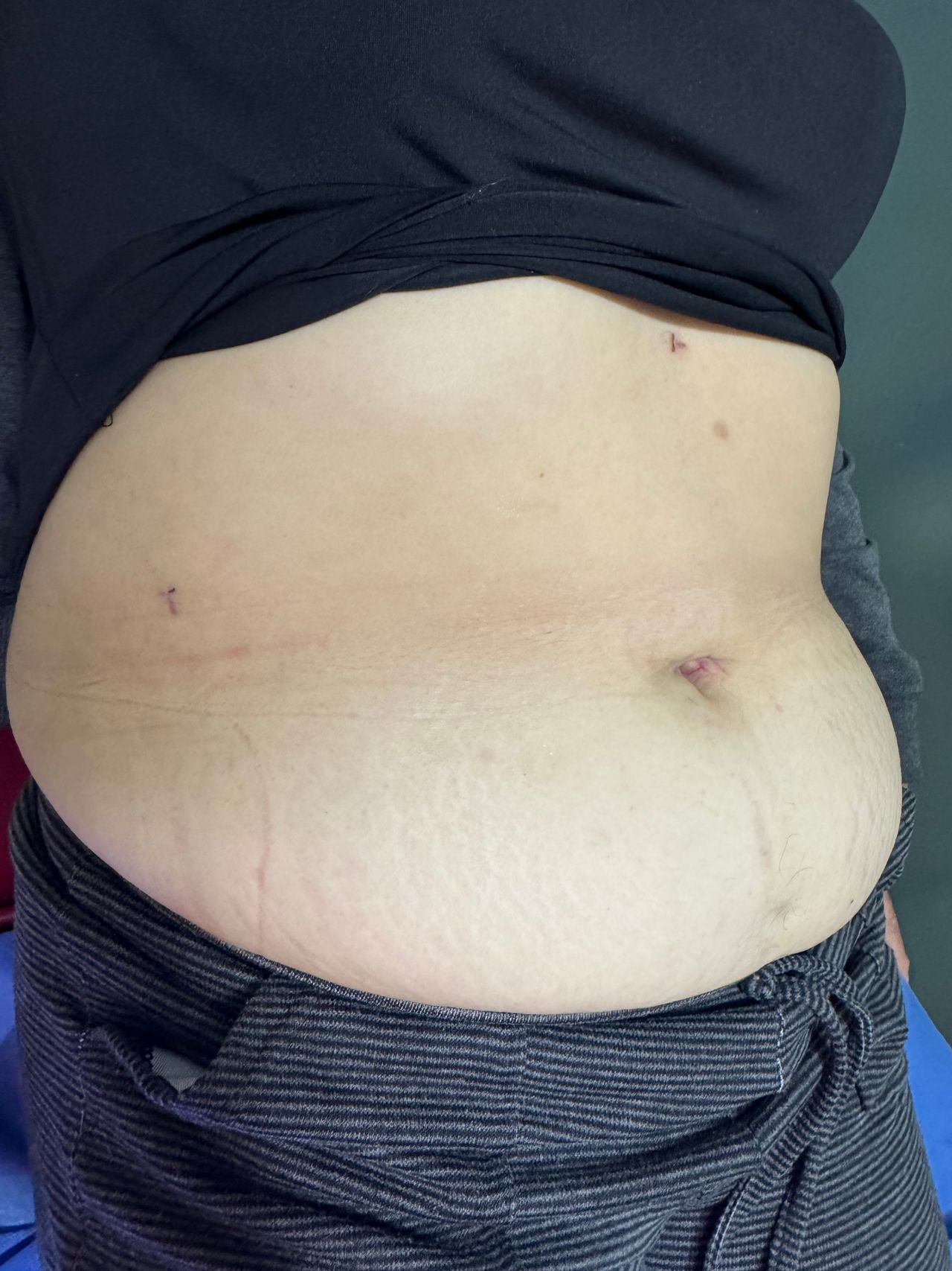 Gerardo Barrera Torres-10