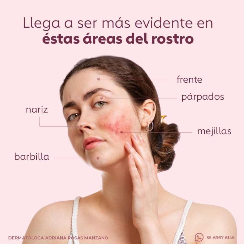 Adriana Rosas Manzano-12