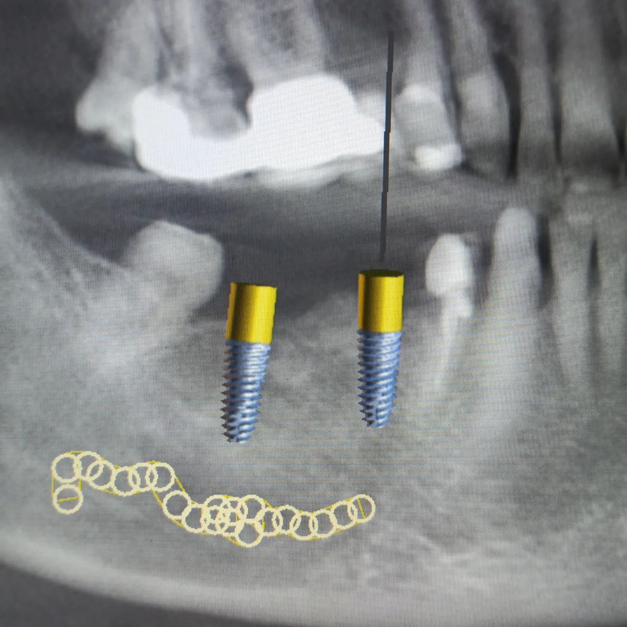 Oscar Cortez Perez-10