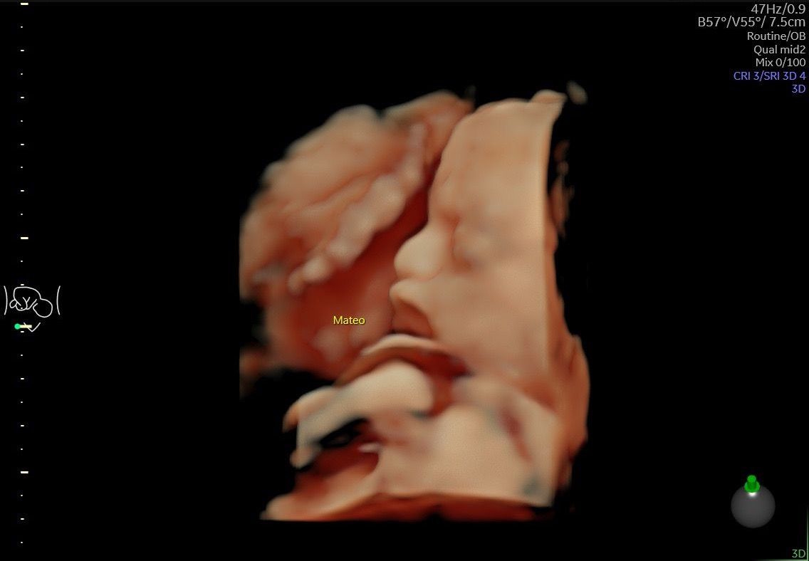 Carlos Arturo Martínez Méndez-10