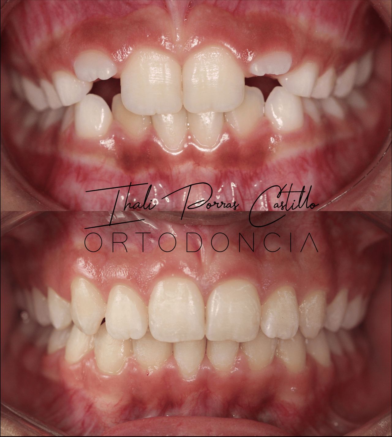 Ihali Porras Castillo-3