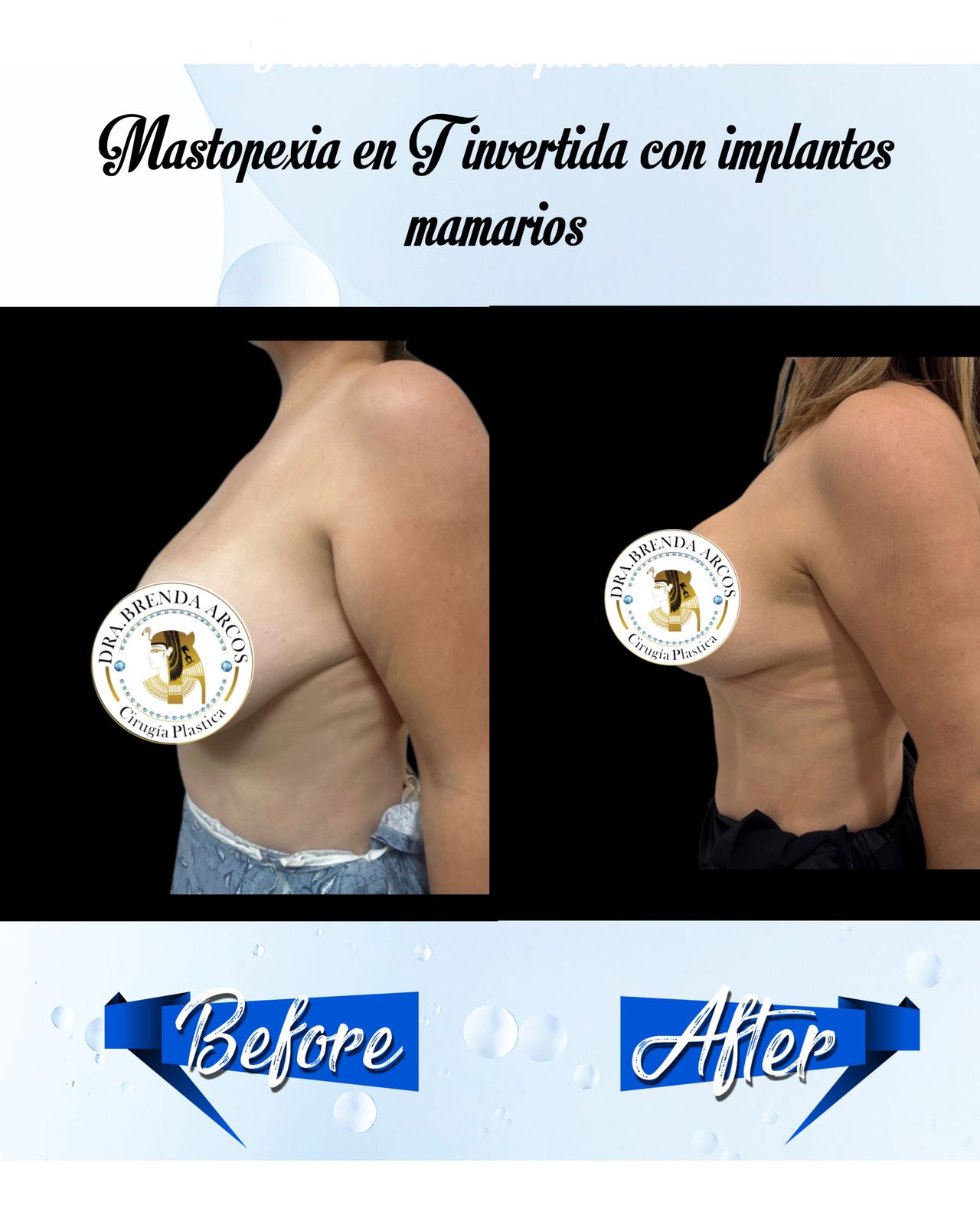 Brenda Arcos Vera-13