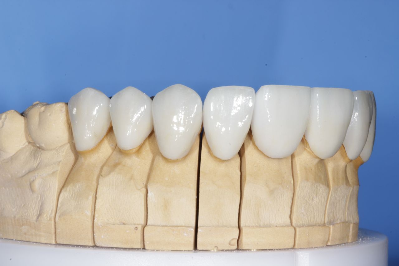 Mariel Itzayani Torres López-40