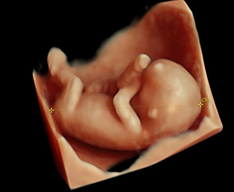 María Teresa Flores Molina-17