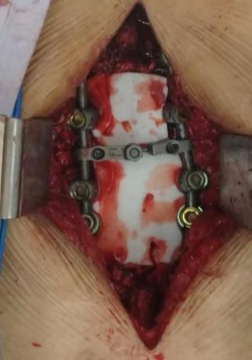 Héctor Francisco Pompa García-14