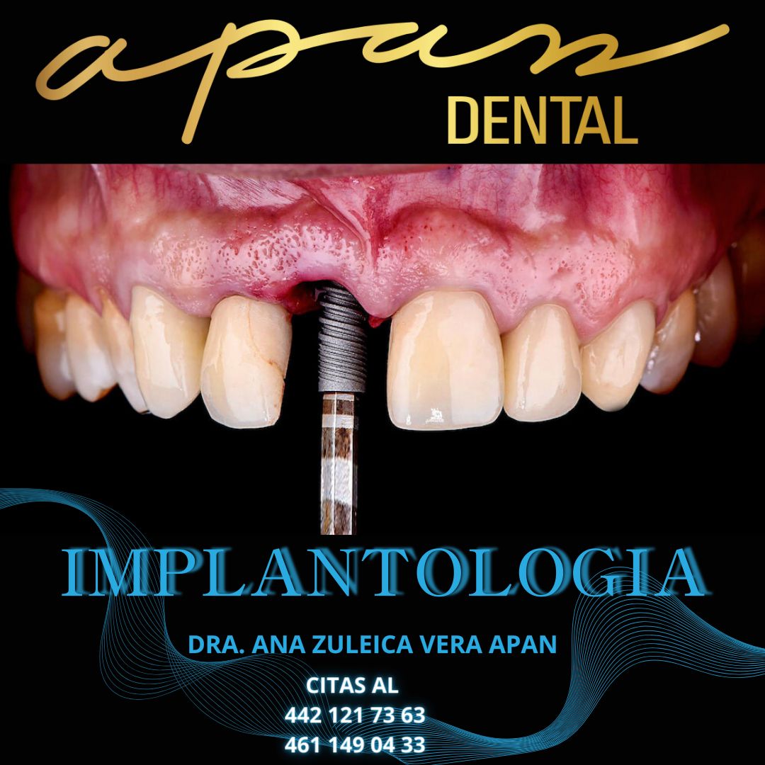 Zuleica Vera Apan-21