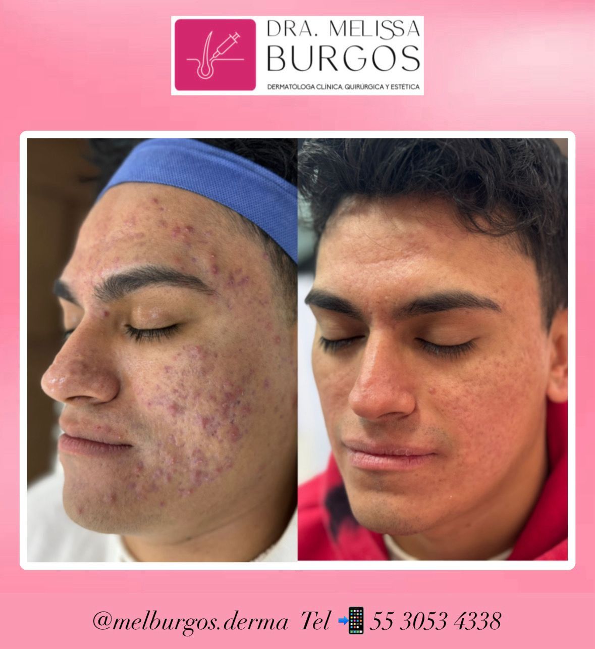 Melissa Burgos Romero-2