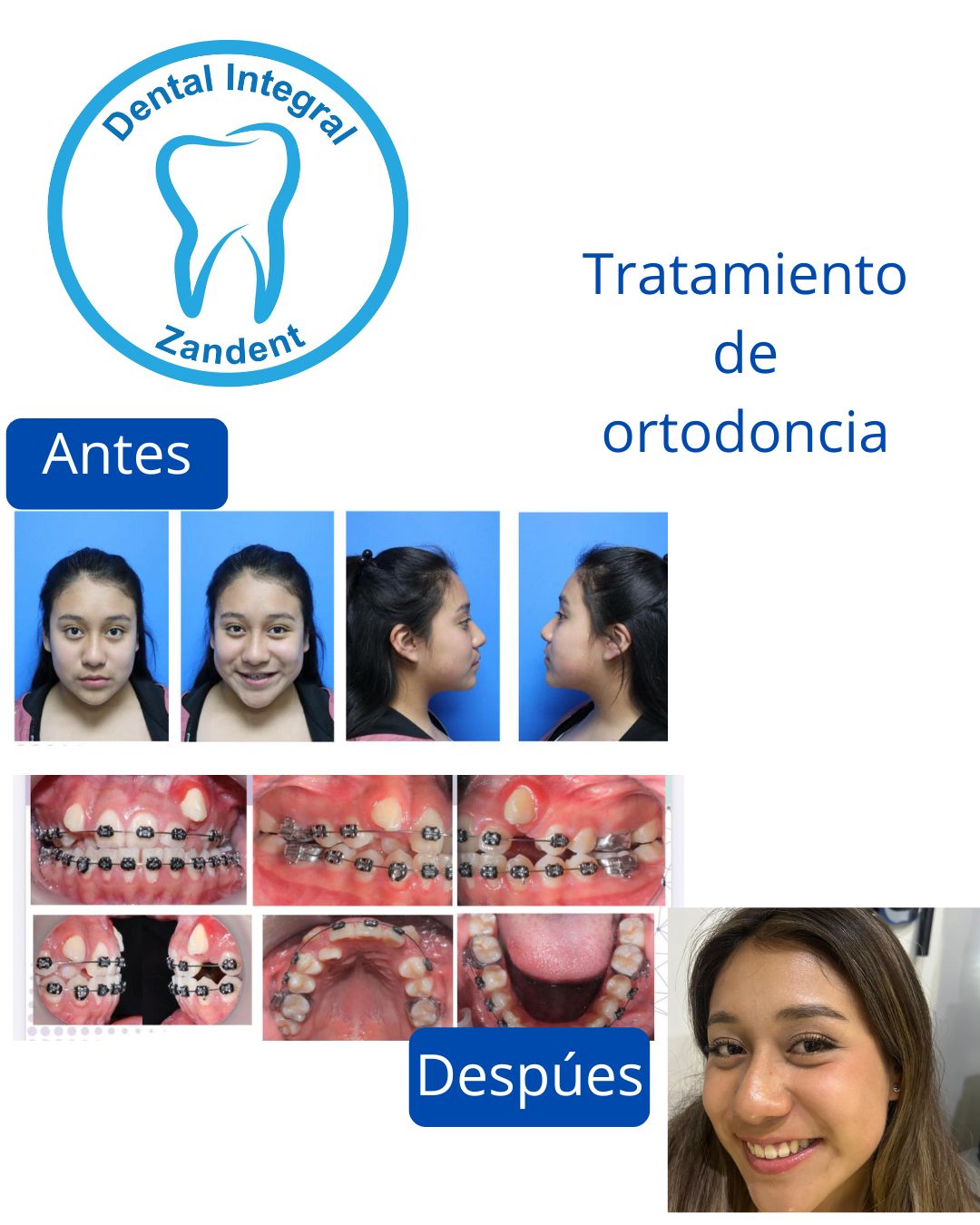Zandra Moctezuma-0
