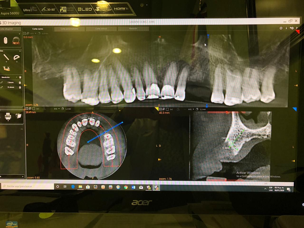 Zuleica Vera Apan-66