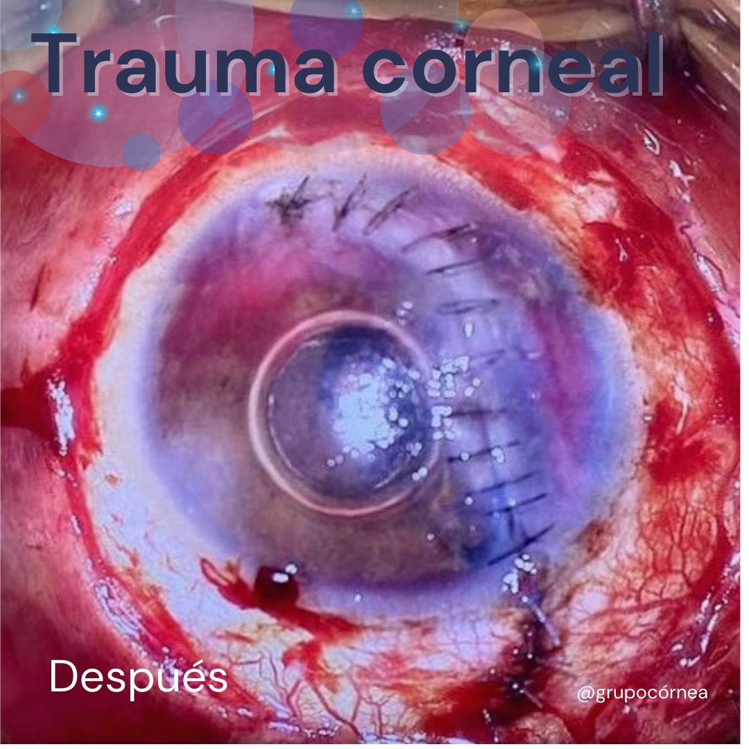 Kristian Alfonso Vazquez Romo-8