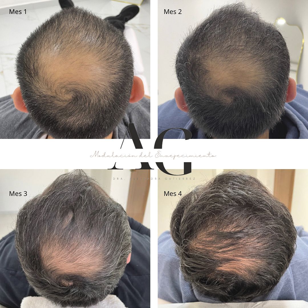 Alejandra Gutierrez García-23