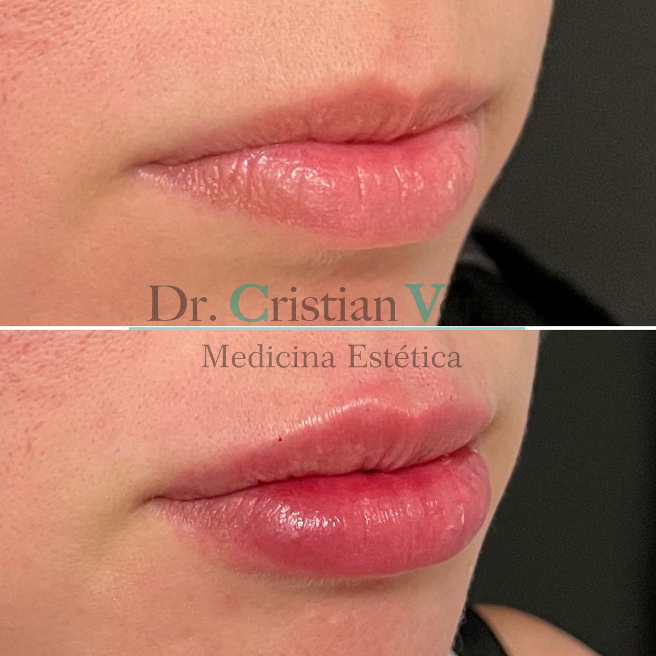 Cristian Eduardo Vera Nuño-17