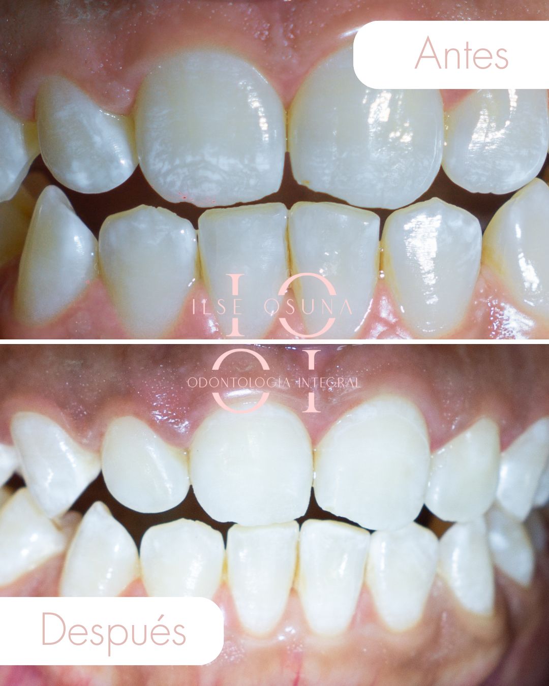 Ilse Valeria Osuna Rodríguez-13