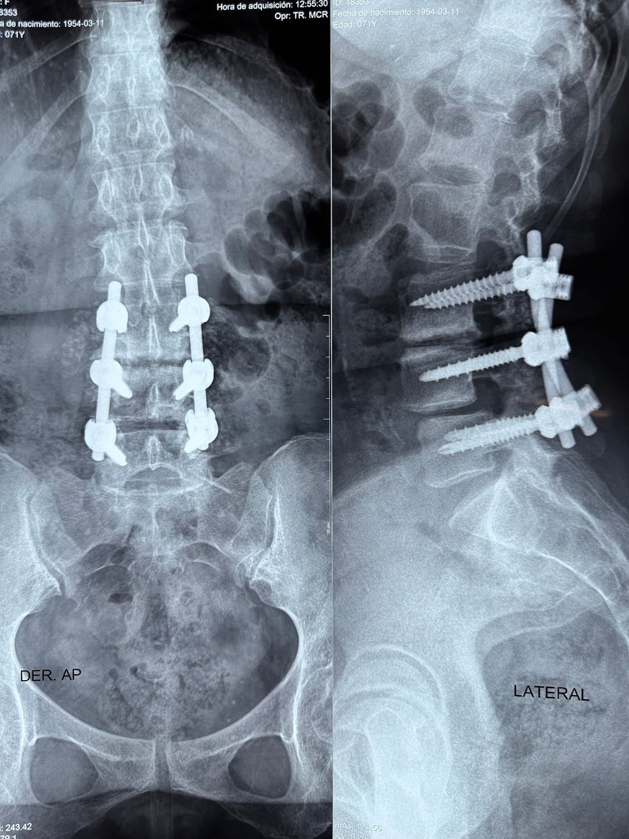 Alejandro Martínez Ramírez-51