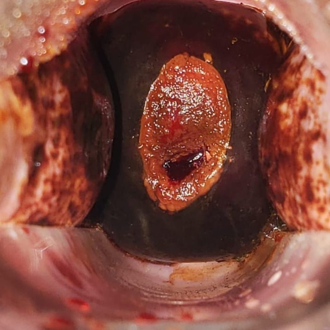 José Israel Aguirre Pérez-7