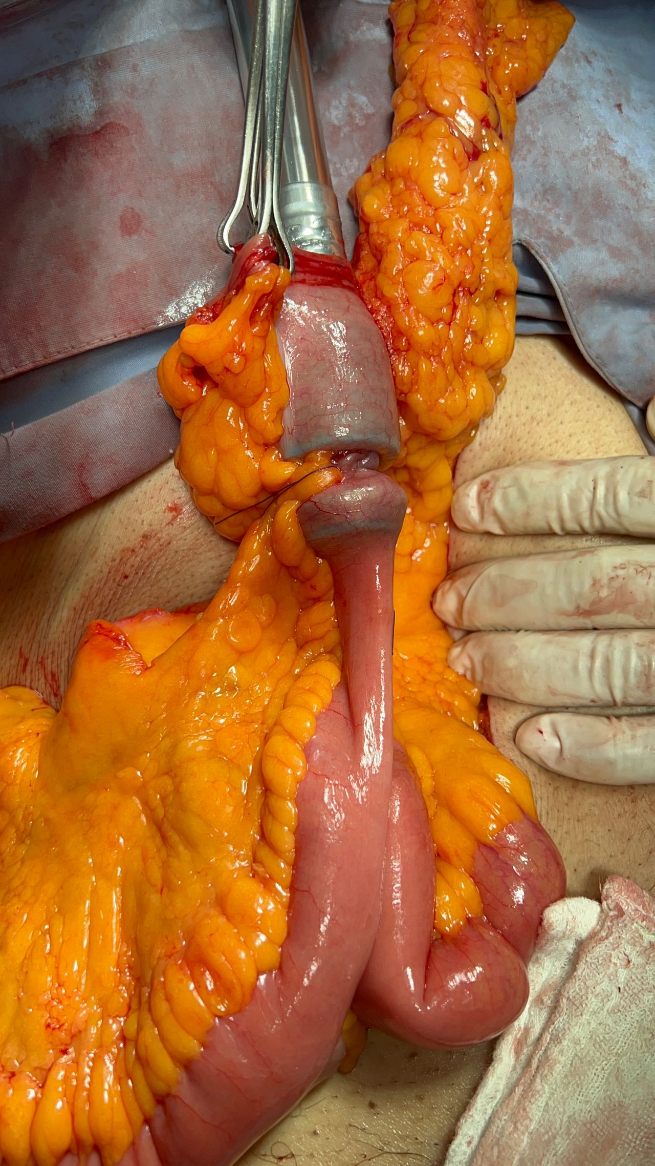 Marco Alejandro Chávez Perea-5