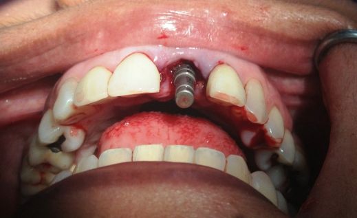 Juan José Castro Mosqueda-1