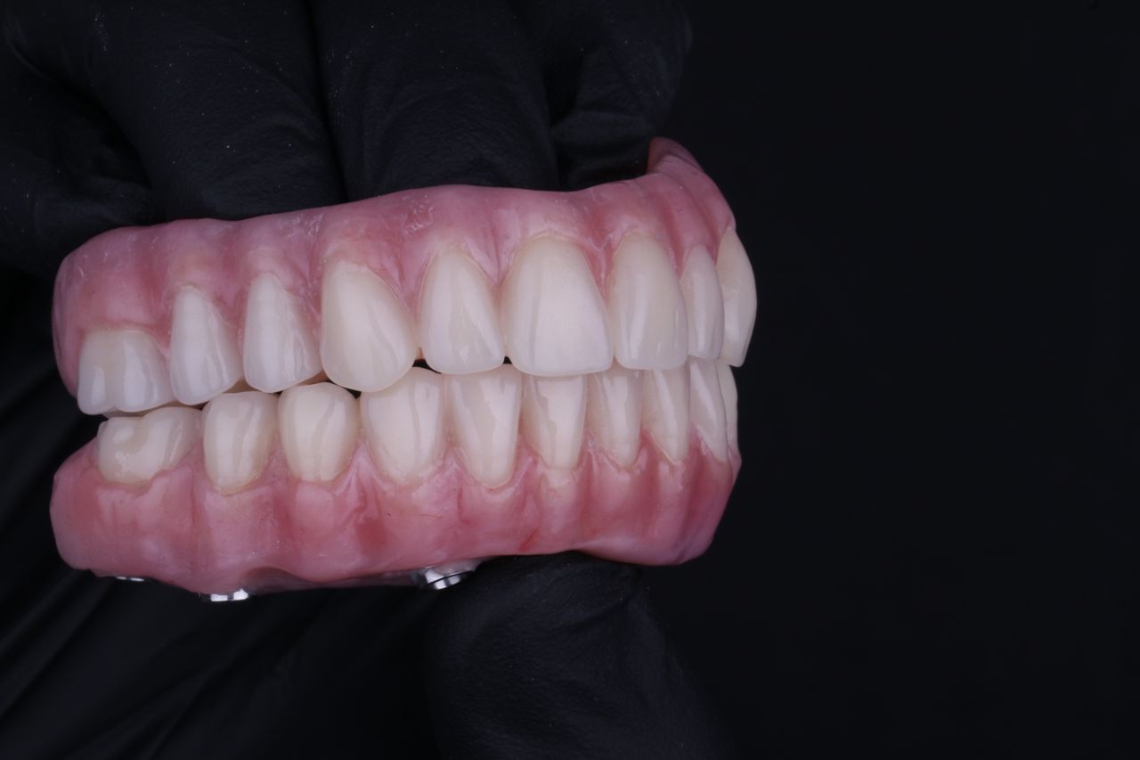 Arturo Mendez Valencia-13