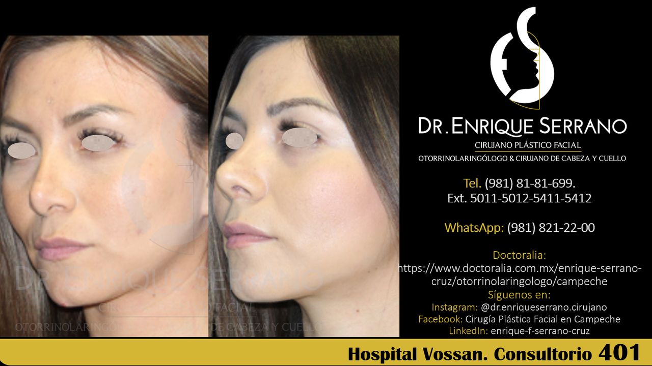 Enrique Serrano Cruz-109