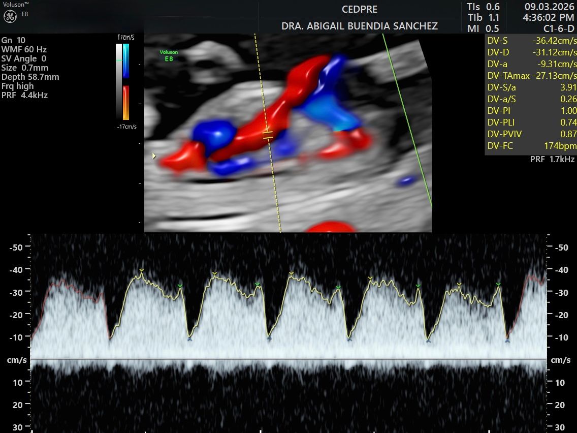 Abigail Buendia Sanchez-4