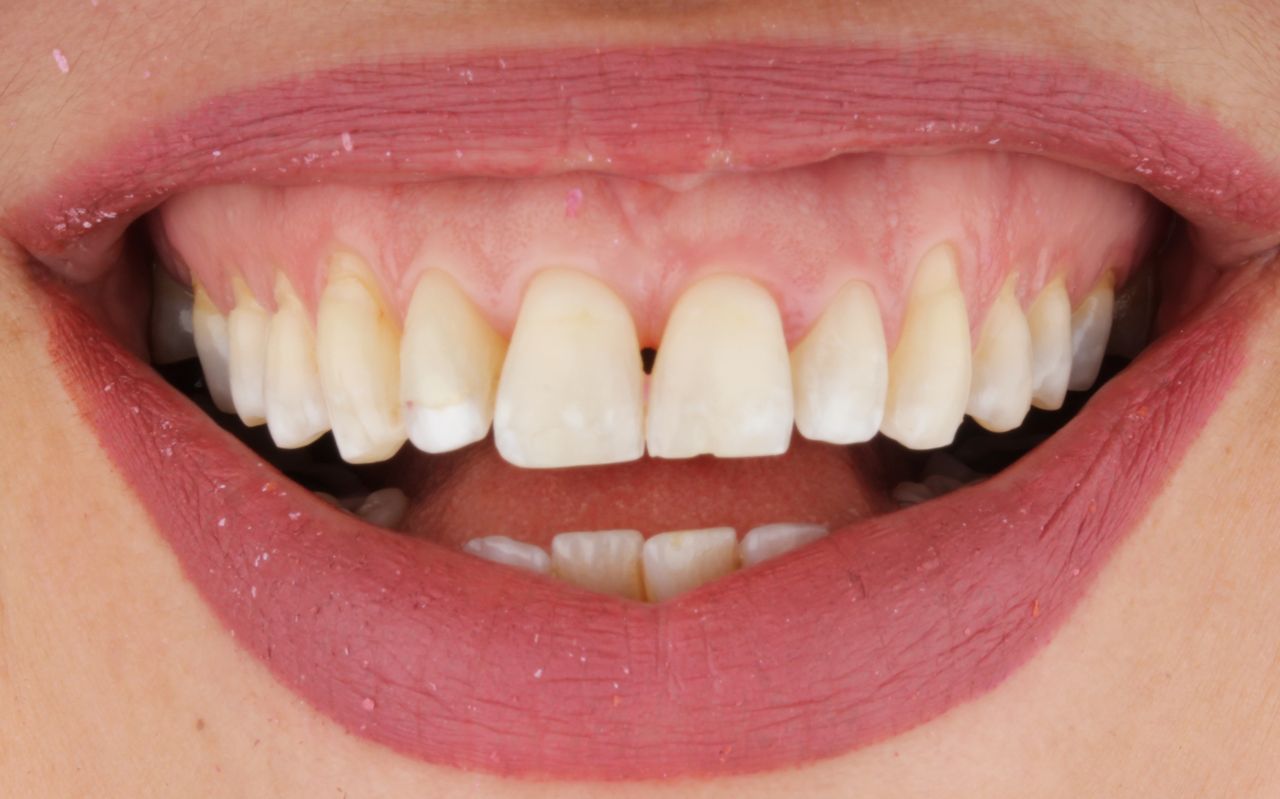 Sebastian Enrique Pérez Alvarez-5