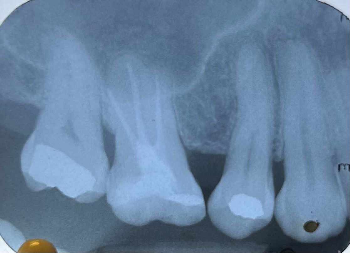 Fernanda Pérez Murrieta-1