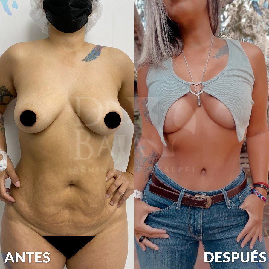 Renato Rodríguez Hirales-30